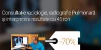 Consultatie radiologie, radiografie pulmonara si interpretare rezultate