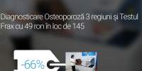 Diagnosticare osteoporoza 3 regiuni si testul Frax